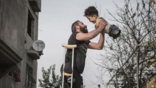 Foto mostra pai e filho afetados pelos efeitos da guerra na Síria