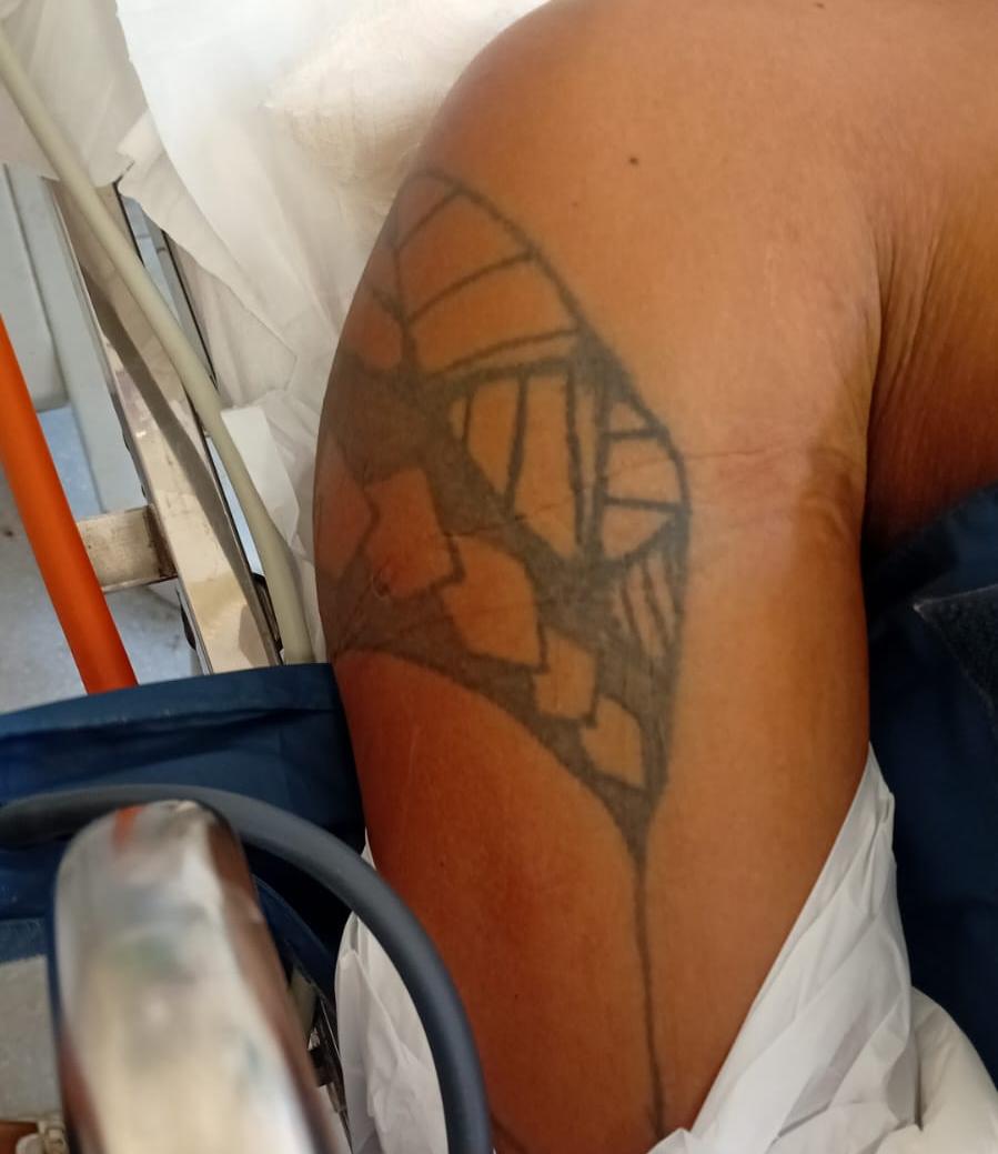 Hospital procura família de paciente internado em UTI sem identificação |  Tocantins