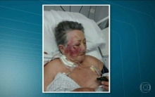 “Bateu até cansar”, disse Idosa de 78 anos após ser agredida por enfermeiro na UTI