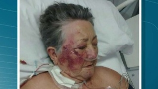 “Bateu até cansar”, disse Idosa de 78 anos após ser agredida por enfermeiro na UTI