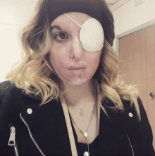 Ex-miss italiana atacada com ácido pelo ex-namorado posta selfie no Instagram 📷