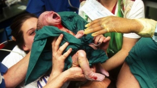 parto nascimento bebê 